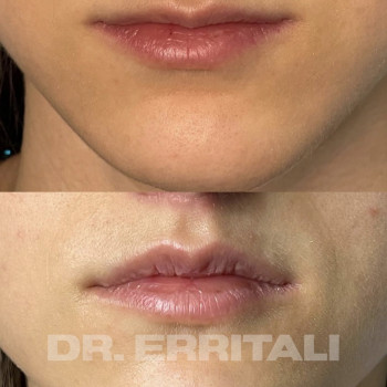 Абдель Эрритали, Харків Фото - 98