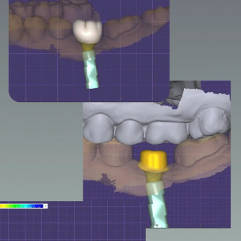 Цифрове планування