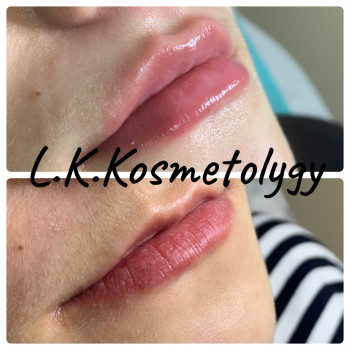 Лариса Петрівна, Луцьк Фото - 80