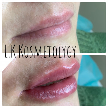 Лариса Петрівна, Луцьк Фото - 87