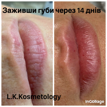 Лариса Петрівна, Луцьк Фото - 89