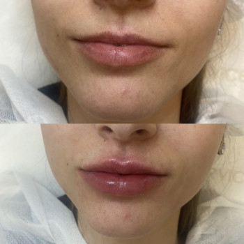 Ідеальні губки