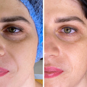 Ирина Малимоненко, Харків Фото - 16