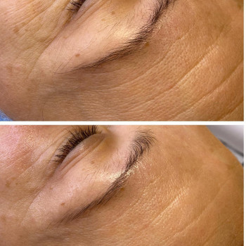 Ирина Малимоненко, Харків Фото - 18