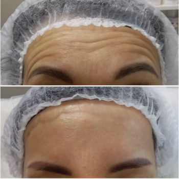 Алла Чеберяк, Луцьк Фото - 10