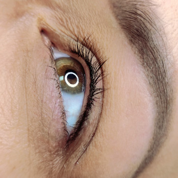 межресничка