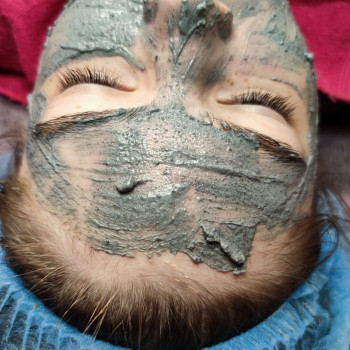 Лечение акне
                    Косметолог-эстетист Анна Харьков