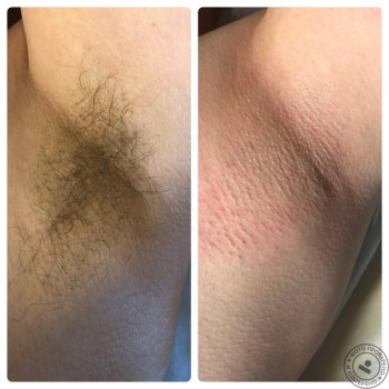 Анна Пьянкова, Киев Фото - 8