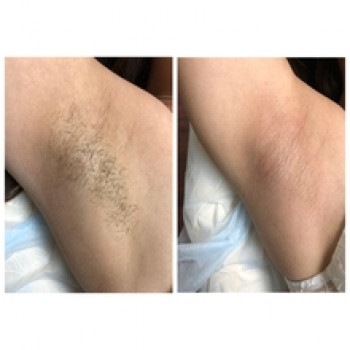 Анна Пьянкова, Киев Фото - 10