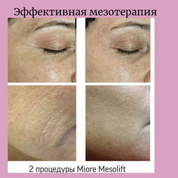 Анна Тарапата, Харьков Фото - 6