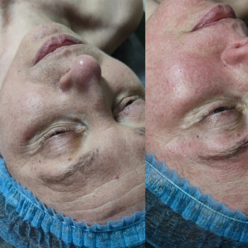 Анна Тарапата, Харьков Фото - 5