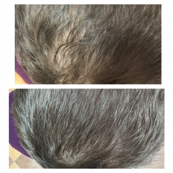 Проведено 8 процедур