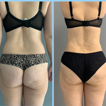 Святослав Ізбенко, Ивано-Франковск Фото - 12