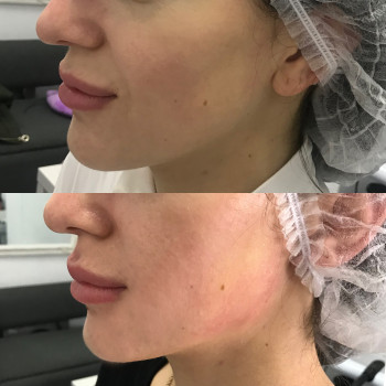 Екатерина Гаврилова, Харьков Фото - 18