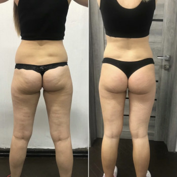 Екатерина Гаврилова, Харьков Фото - 20