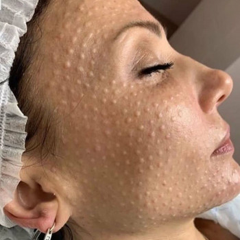 Инь Янь, Борисполь Фото - 3