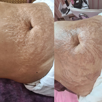 Наталья Цветкова, Киев Фото - 33