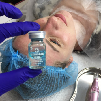 Фракционная мезотерапия лица
                    Косметолог Анна Харків