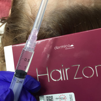 Мезотерапия волос
                    Косметолог Анна Харьков