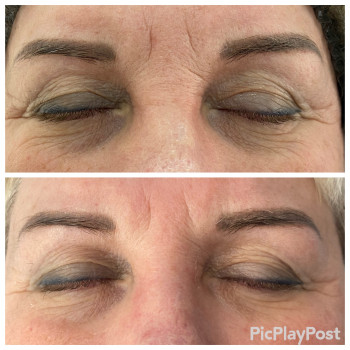 SMAS Массаж лица
                    СПА-салон GARNA Мариуполь