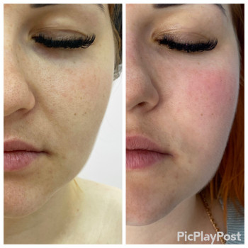 SMAS Массаж лица
                    СПА-салон GARNA Мариуполь