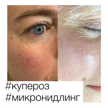 Людмила Чайка, Київ Фото - 6