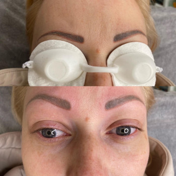 Удаление тату и татуажа
                    Мастер перманентного макияжа Инна Запорожье