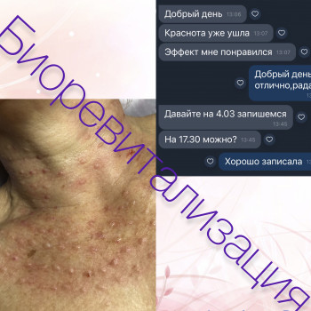 Марина Копыл, Днепр Фото - 33