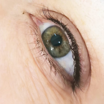 Межресничка