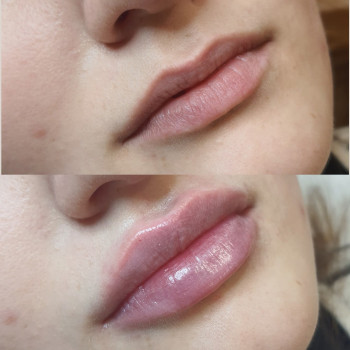 Ліна Гетьман, Тернополь Фото - 12