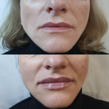 Ліна Гетьман, Тернополь Фото - 13