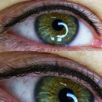 Межресничка