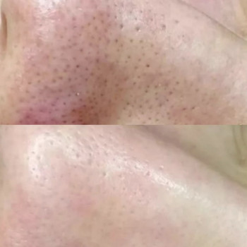 Елена Новицкая, Одесса Фото - 16