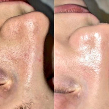 Елена Новицкая, Одесса Фото - 17