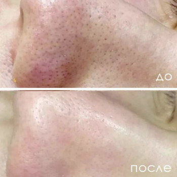 Елена Новицкая, Одесса Фото - 19