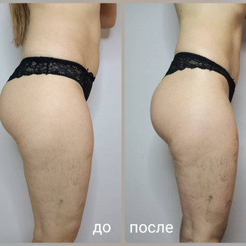 Міла Моісеєнко, Херсон Фото - 23