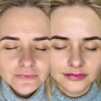 Рона Тудай, Харків Фото - 6