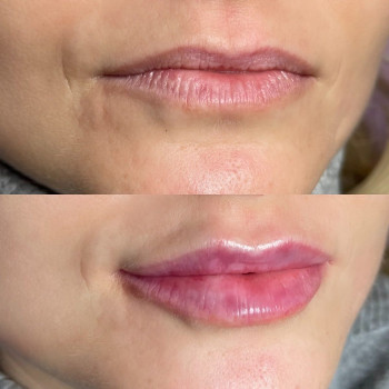 Рона Тудай, Харків Фото - 7