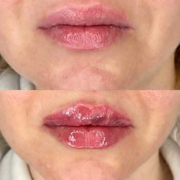 Рона Тудай, Харків Фото - 8