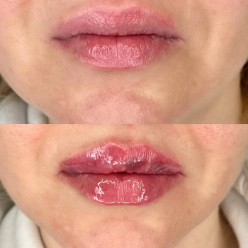 Губки До/ После