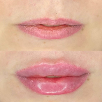 Губки До/ После