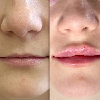 Губки До/ После