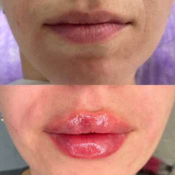 Губки До/ После