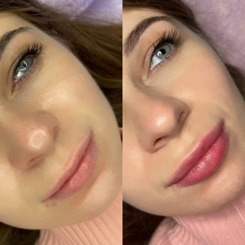 Губки До/ После