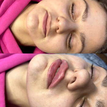 Губки До/ После