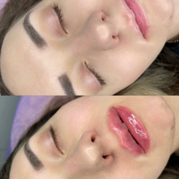 Губки До/ После