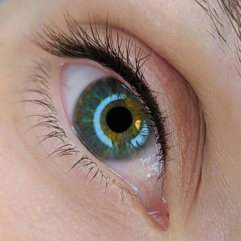 Межресничка