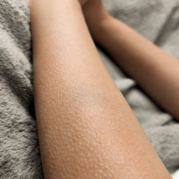 Анна , Рівне Фото - 12