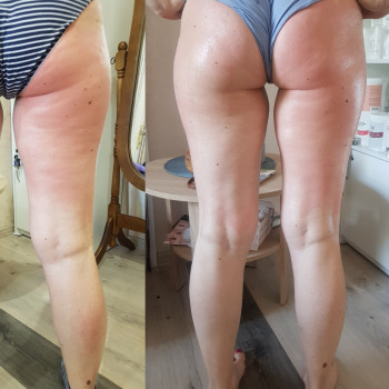 Масаж тіла Старвак
                    Салон красоты Body and face sculpture Киев