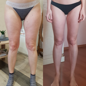 Масаж тіла Старвак
                    Салон красоты Body and face sculpture Киев